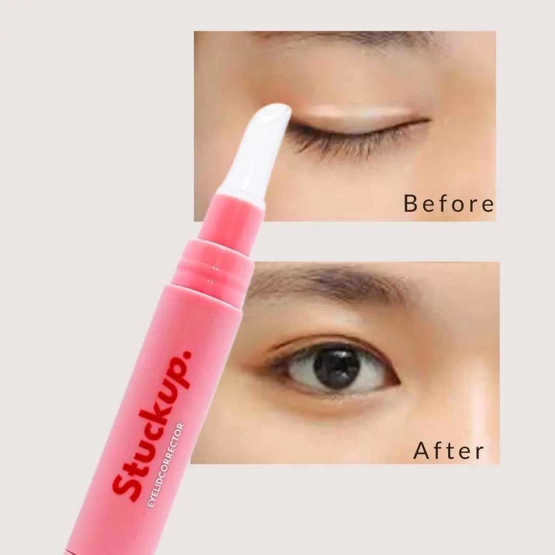 Before and after image showing instant eyelid lift results using StuckUp Beauty Eyelid Corrector for hooded eyes and monolids.