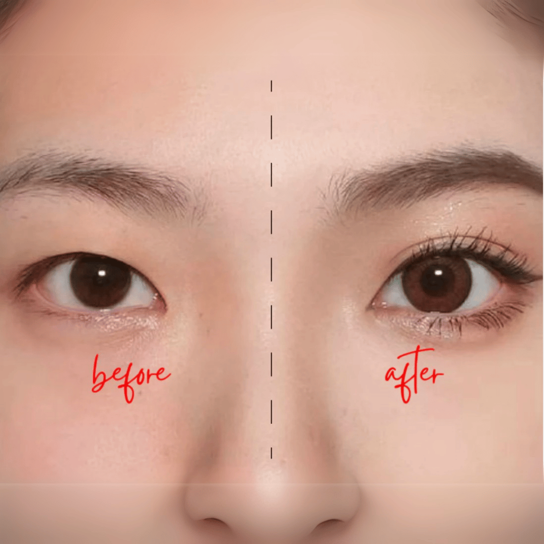 Before and after comparison showing instant eyelid lift results using StuckUp Beauty double eyelid glue for hooded eyes and monolids.